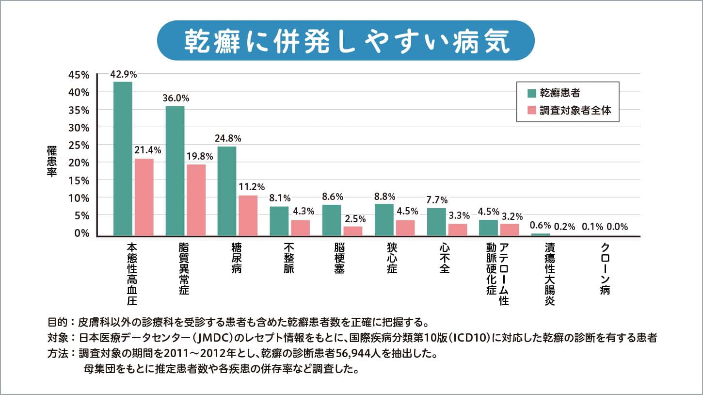 パーキンソン病の治療