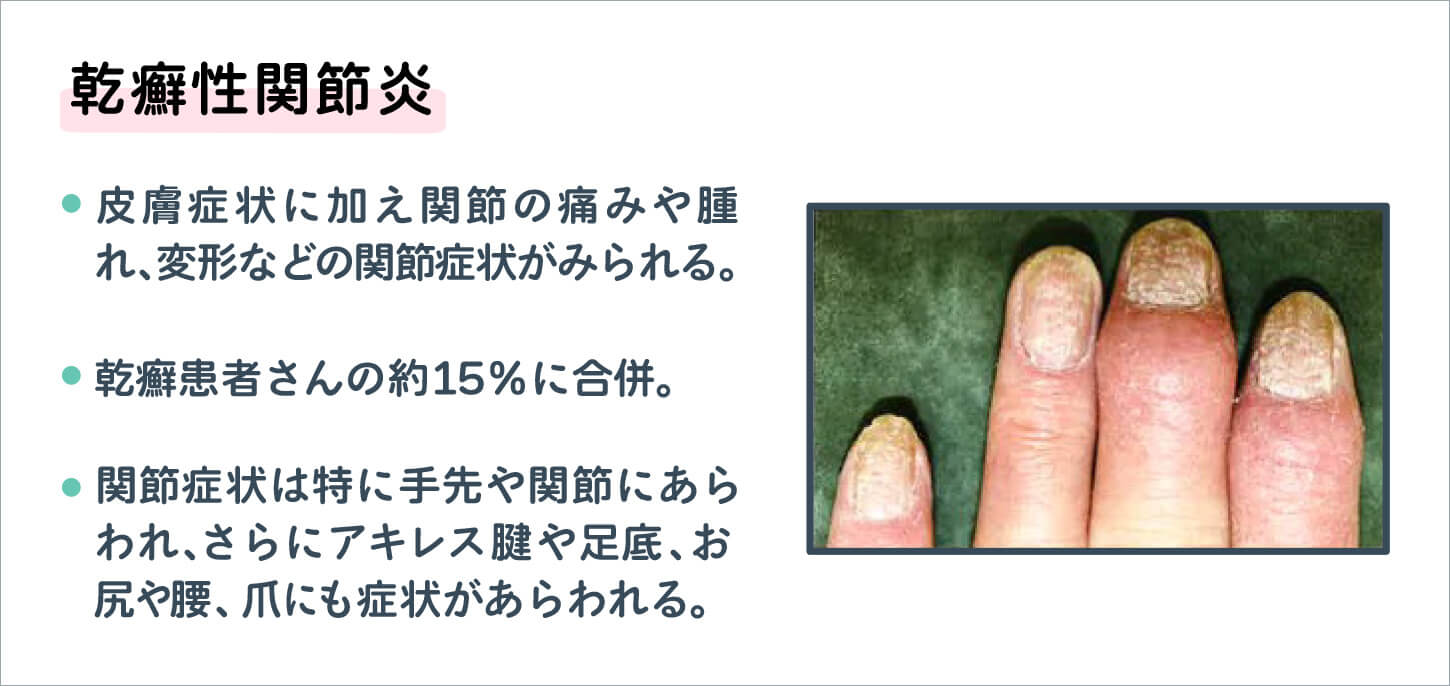 7. 適切なサポートギアを着用する