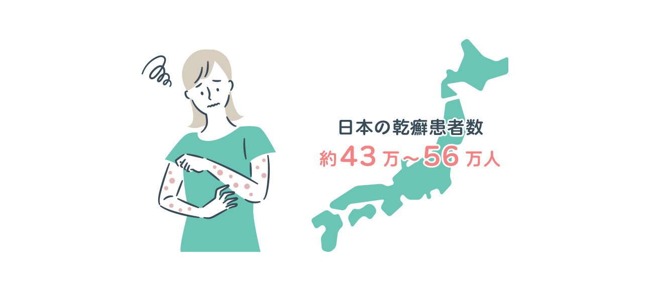 日本の乾癬患者数 約43万~56万人